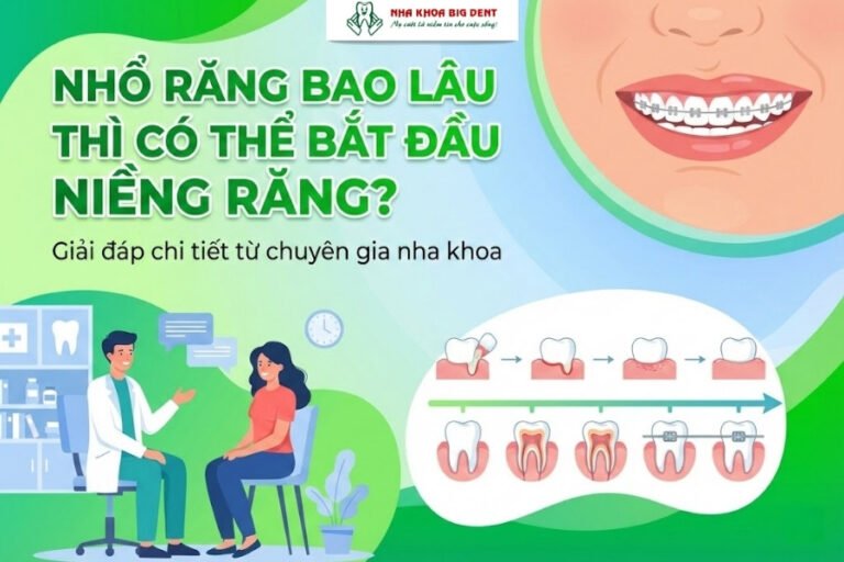 nhổ răng bao lâu thì niềng