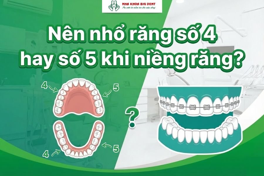 nhổ răng số 5 khi niềng răng