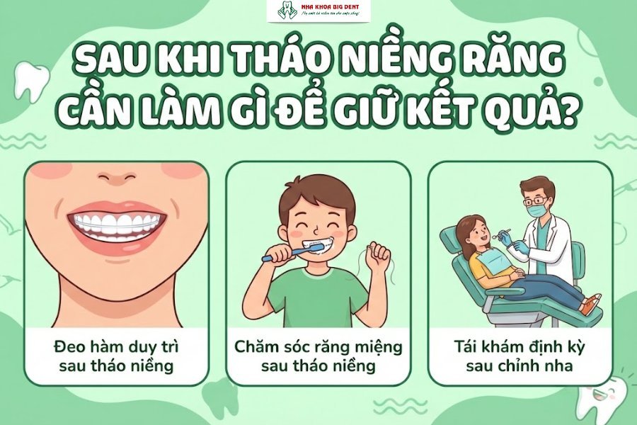 niềng răng bao lâu thì tháo