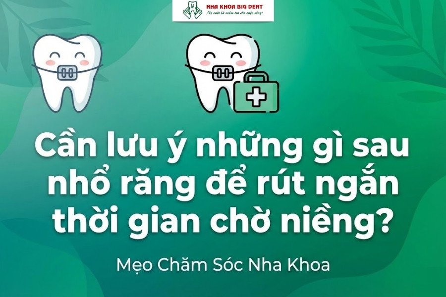 nhổ răng bao lâu thì niềng