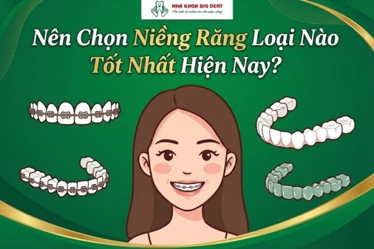 niềng răng loại nào tốt nhất