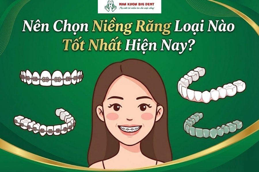 niềng răng loại nào tốt nhất