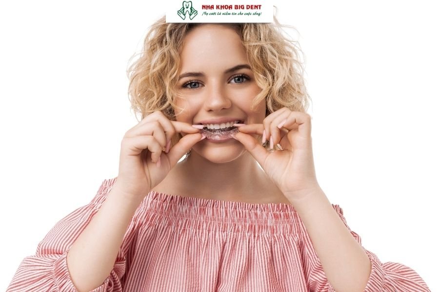 niềng răng trong suốt