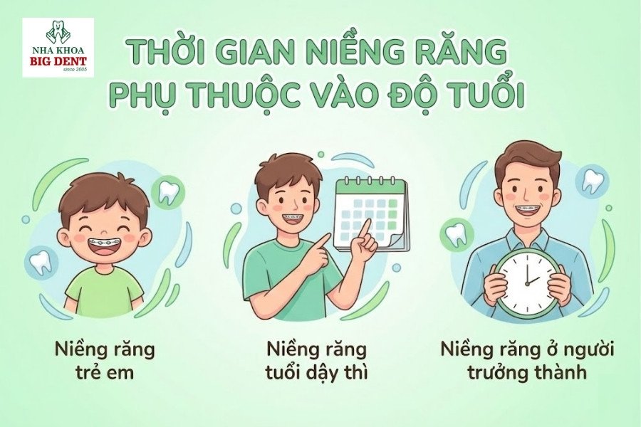 niềng răng mất bao lâu