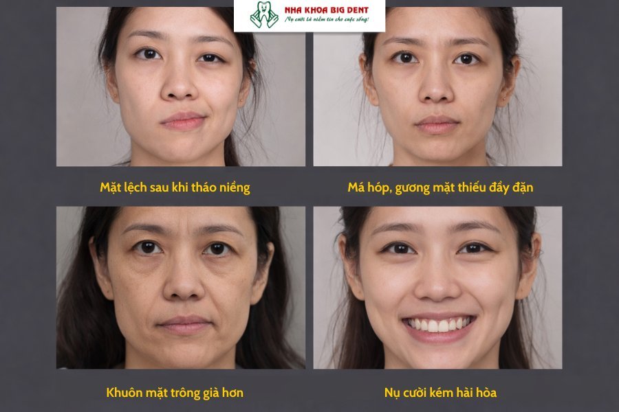 niềng răng hỏng