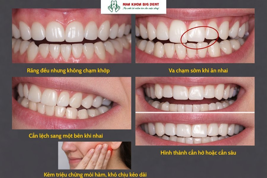 niềng răng hỏng