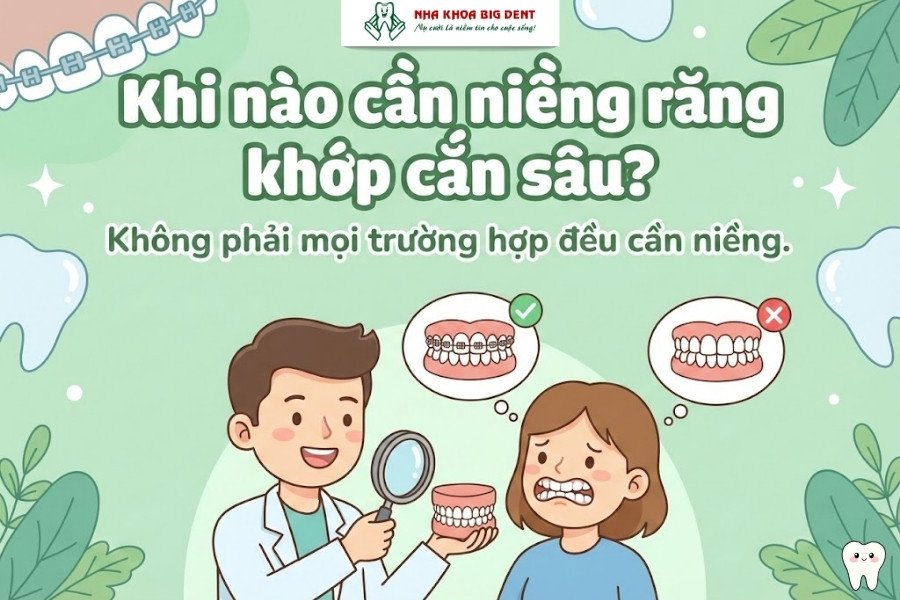 quy trình niềng răng khớp cắn sâu
