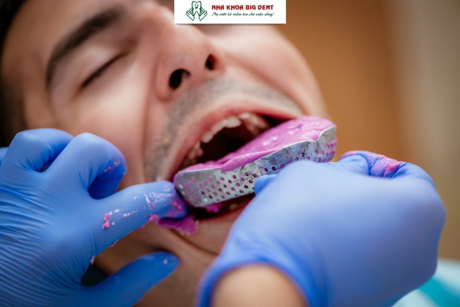 quy trình niềng răng khớp cắn sâu