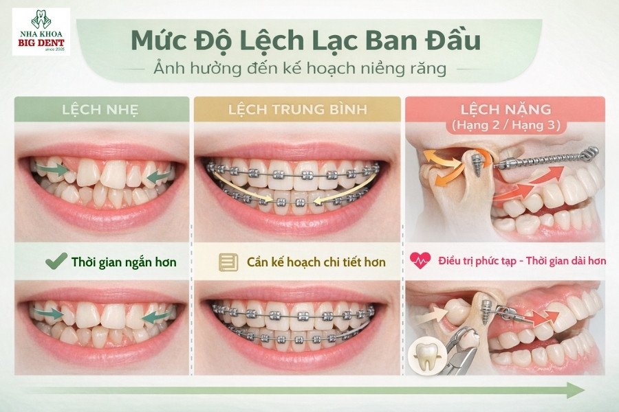 niềng răng người lớn