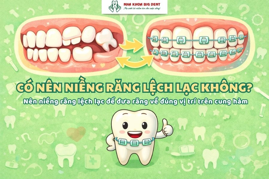niềng răng lệch lạc
