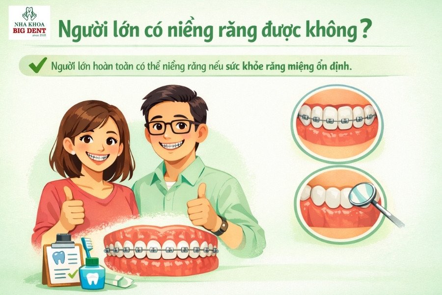 niềng răng người lớn