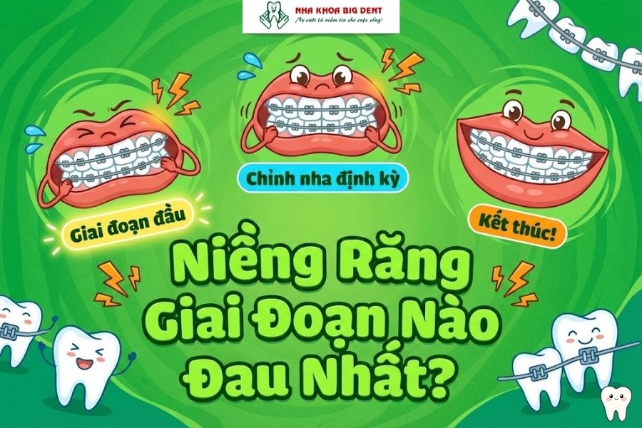 Niềng răng giai đoạn nào đau nhất