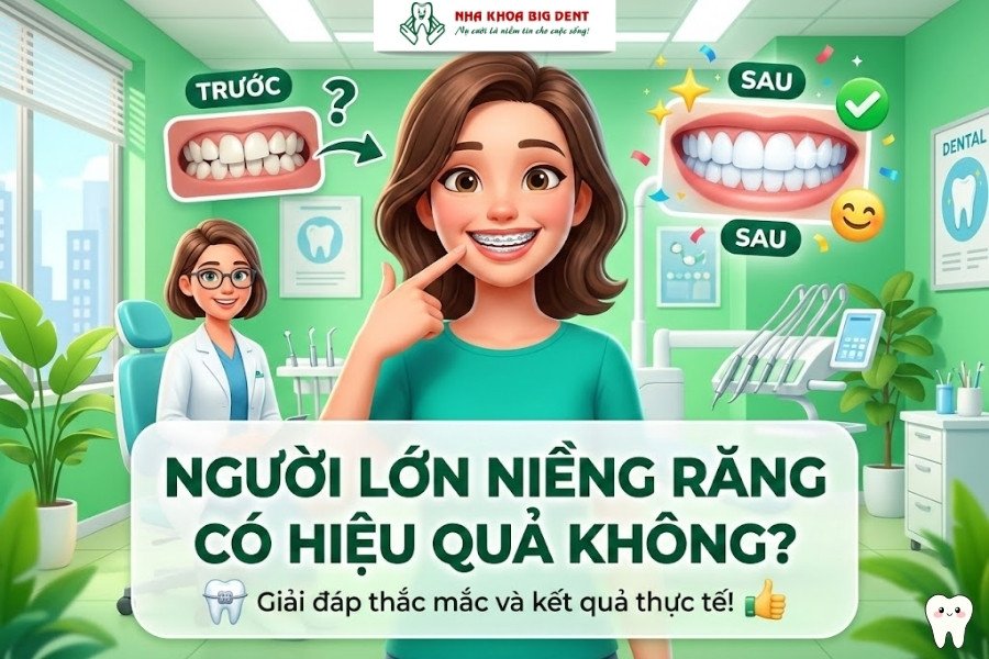 niềng răng người lớn