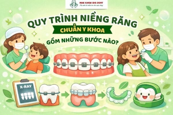 quy trình niềng răng