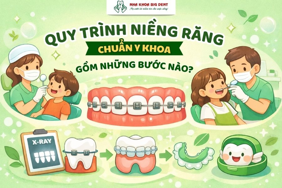 quy trình niềng răng