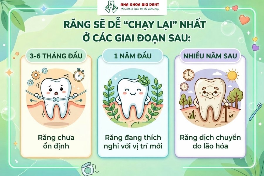 niềng răng có được vĩnh viễn không