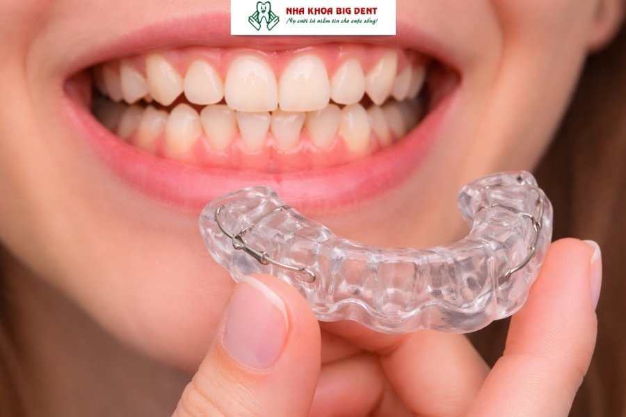 Không đeo hàm duy trì