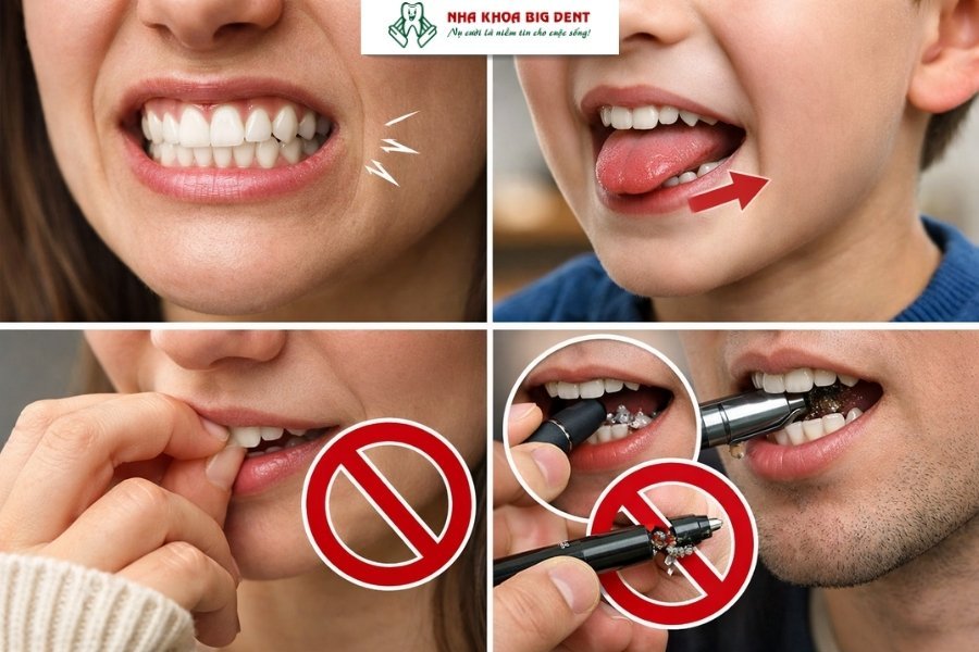 niềng răng có được vĩnh viễn không