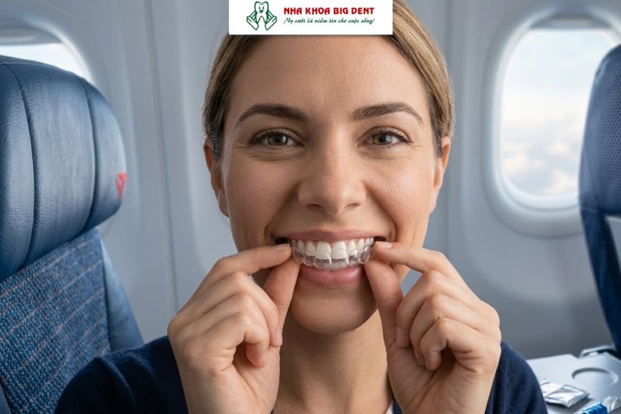niềng răng có đi máy bay được không