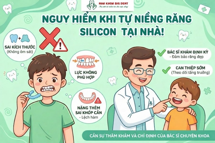 niềng răng silicon