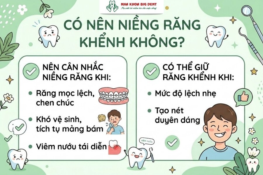 niềng răng khểnh