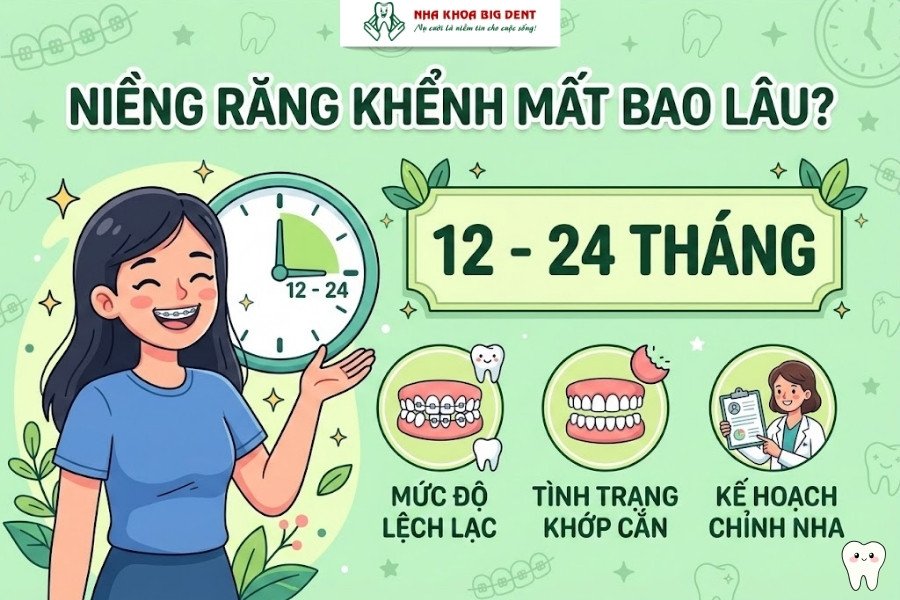 niềng răng khểnh