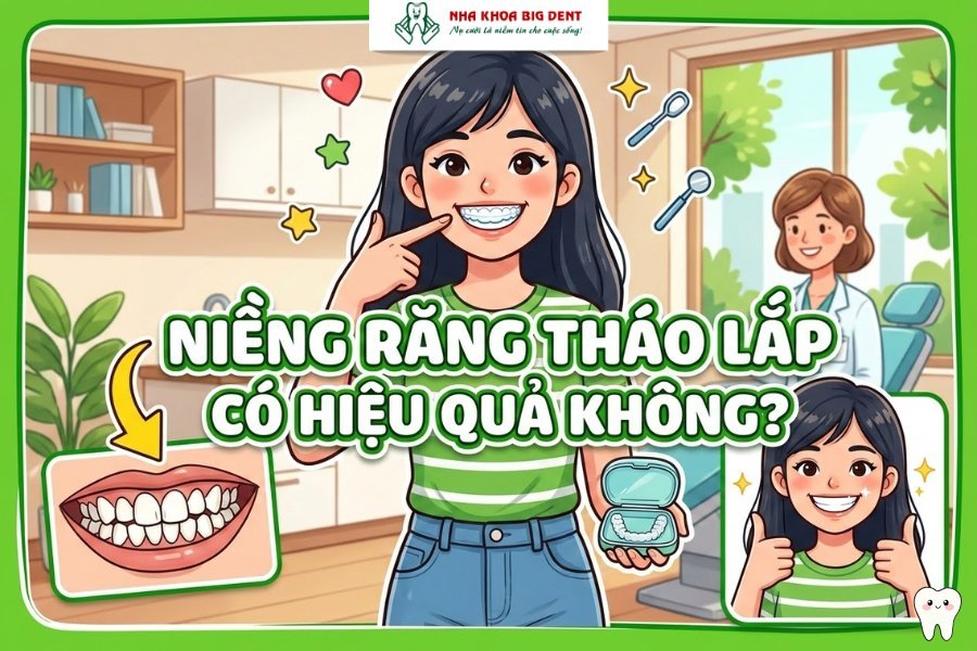 niềng răng tháo lắp