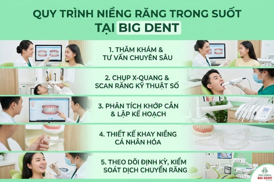 niềng răng tháo lắp