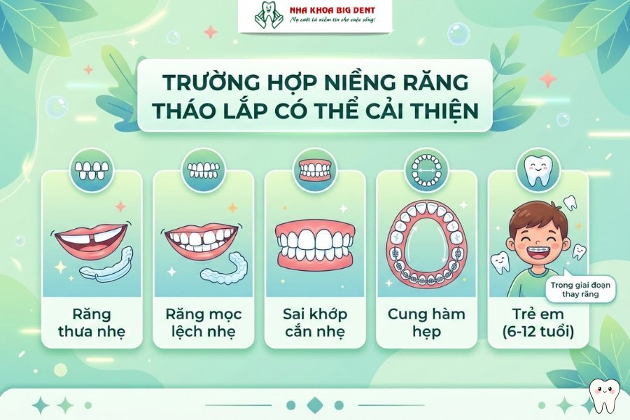 niềng răng tháo lắp