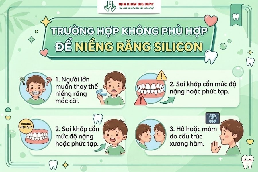 niềng răng silicon