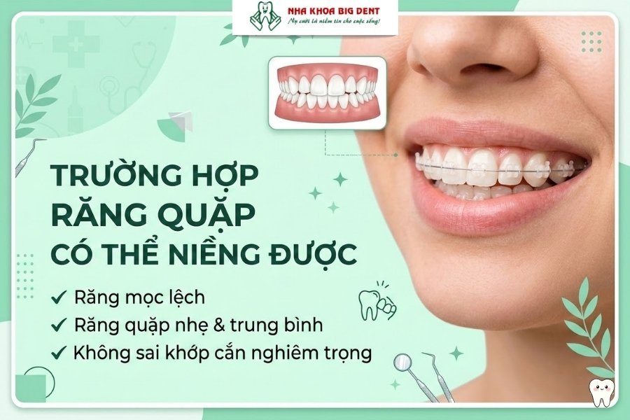 răng quặp có niềng được không