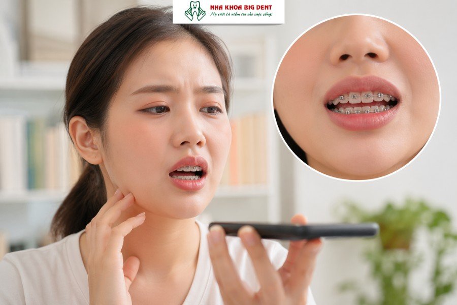 những dấu hiệu khi mới niềng răng