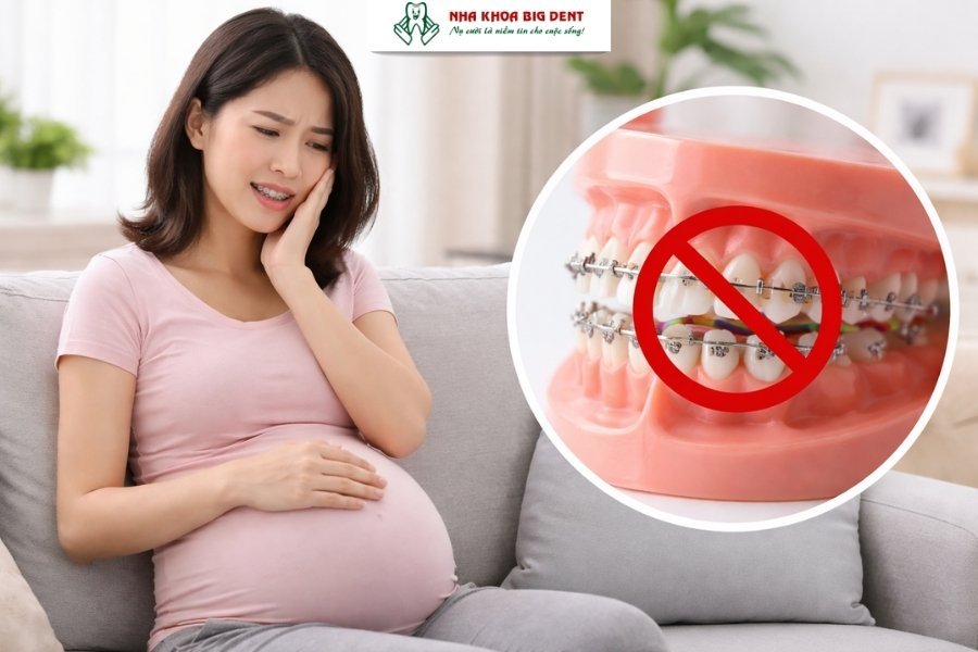 những điều cần biết trước khi niềng răng