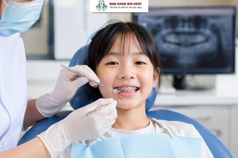 lưu ý khi niềng răng cho trẻ