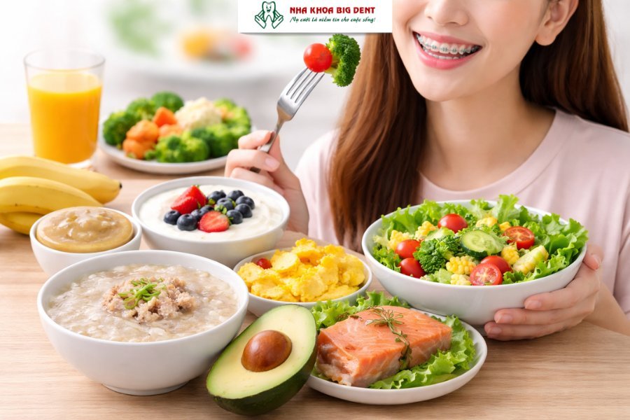 những điều cần biết trước khi niềng răng