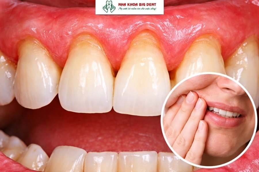 niềng răng có làm răng dài ra không