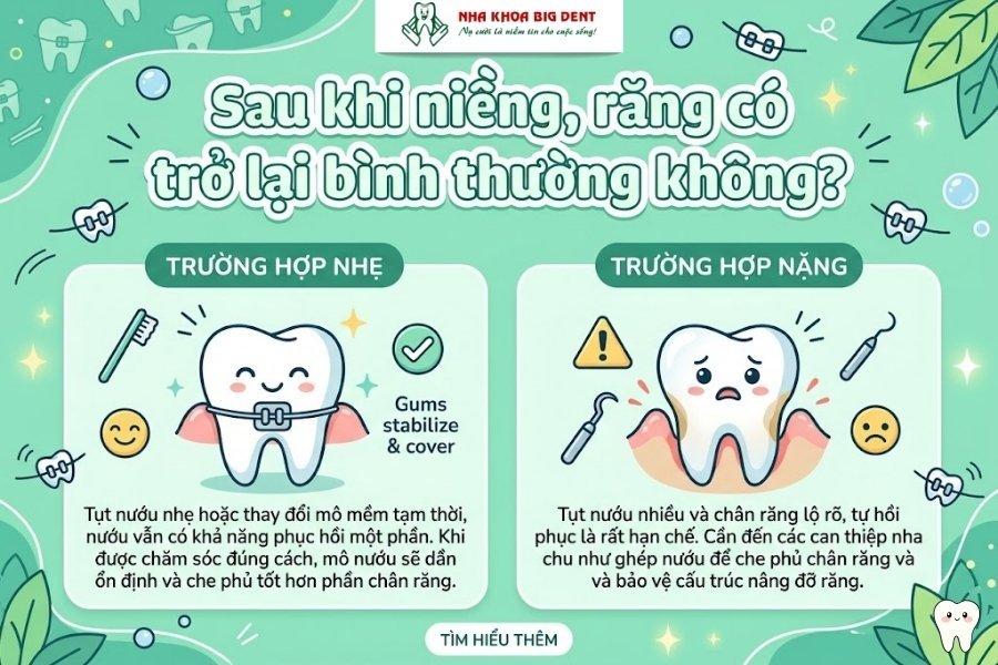 niềng răng có làm răng dài ra không