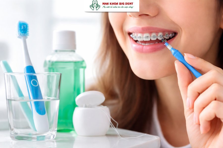 niềng răng có tẩy trắng răng được không