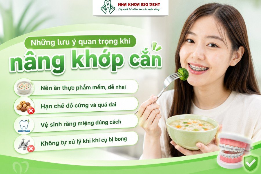 nâng khớp cắn khi niềng răng