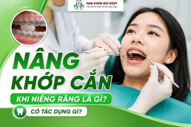 nâng khớp cắn khi niềng răng
