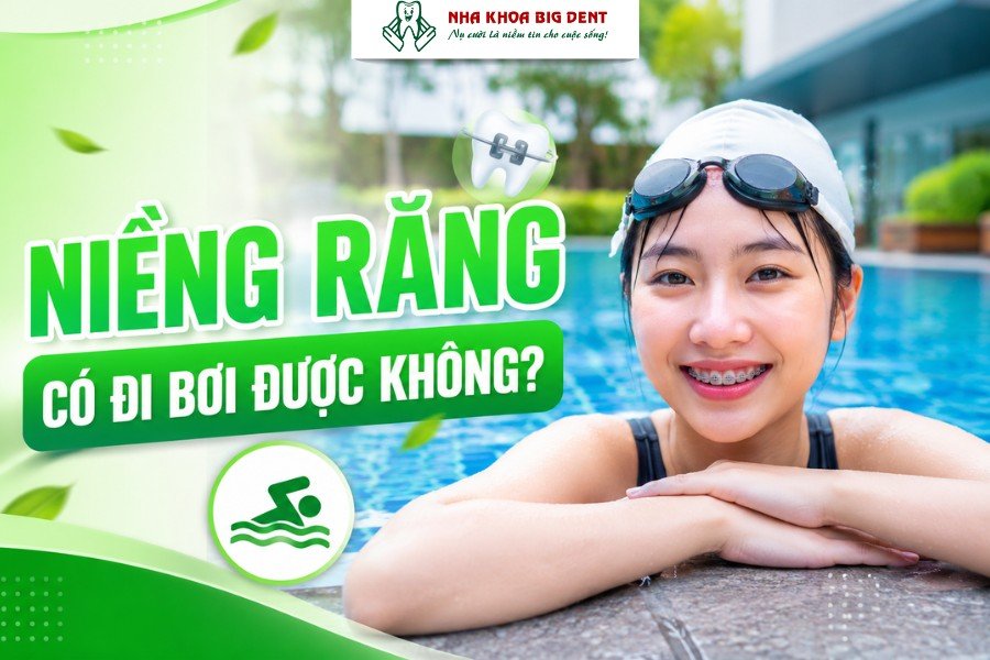 niềng răng có đi bơi được không