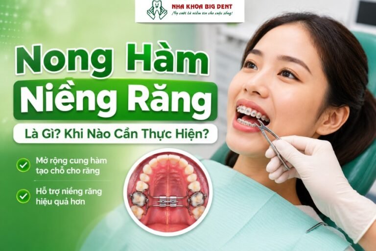 Nong hàm niềng răng