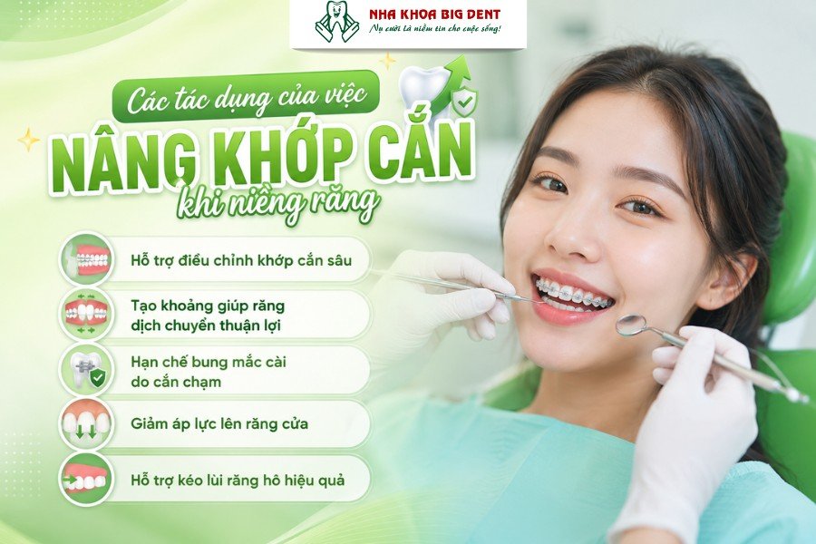 nâng khớp cắn khi niềng răng