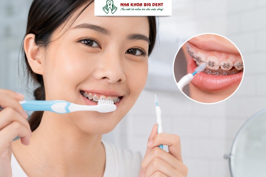 niềng răng có làm răng yếu đi không