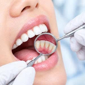 Bảo tồn răng thật tuyệt đối khi chỉnh nha niềng răng