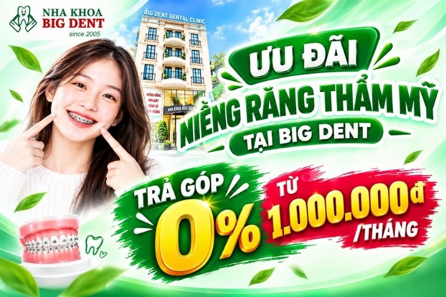 ưu đãi niềng răng thẩm mỹ