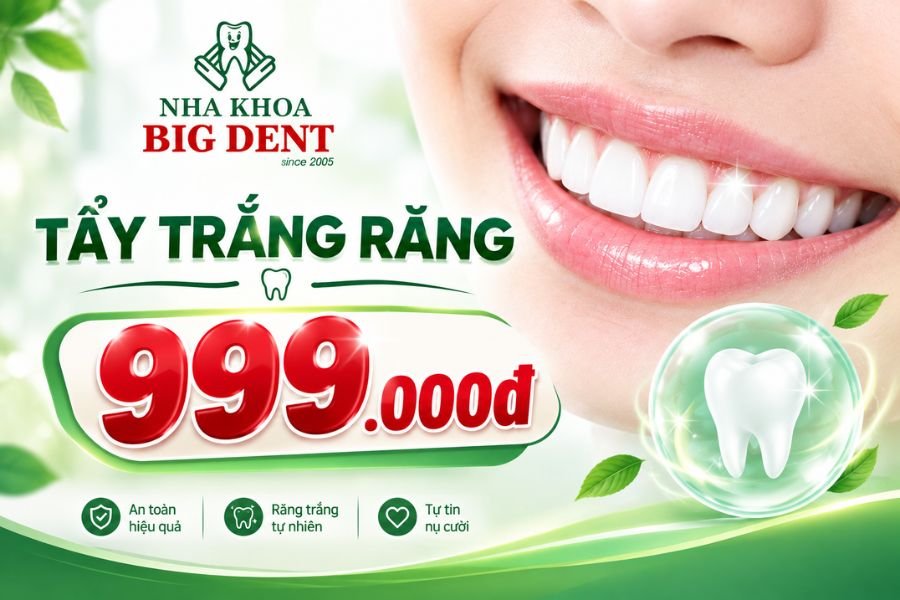 Ưu đãi tẩy trắng răng